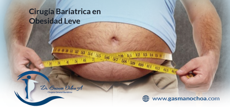 Cirugía Batríatrica en Obesidad Leve
